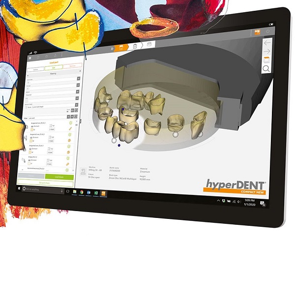 hyperDENT Additonal modules